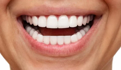 After dental treatment - improved patient smile
