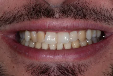 Before dental treatment - patient smile